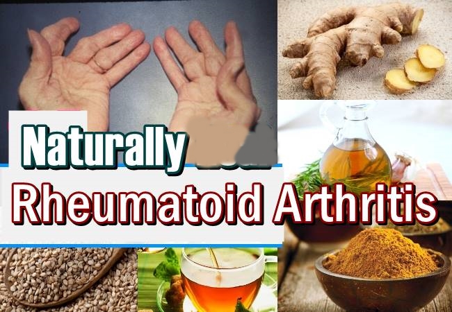 How to Treat Rheumatoid Arthritis Naturally