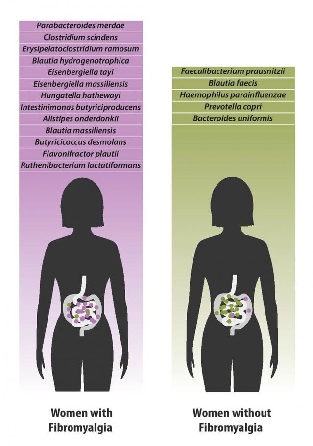 fibromyalgia and gut bacteria women