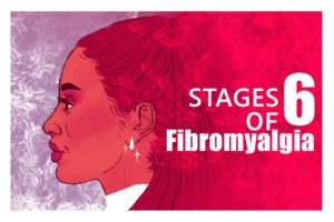 Read more about the article Stages of Fibromyalgia, Check Your Stage Now