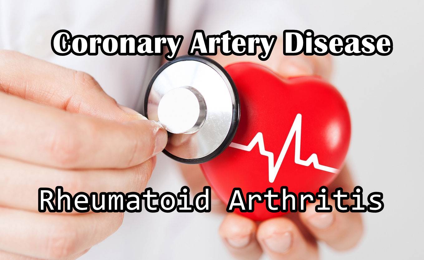 You are currently viewing Rheumatoid Arthritis Congestive Heart Failure